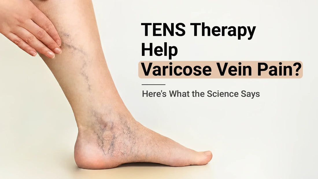 Close-up of a leg showing visible varicose veins, explaining whether TENS therapy can help relieve varicose vein pain naturally.