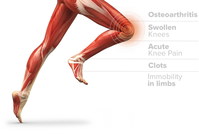 Knee Pulse is benefited in osteoarthritis, swollen knees, acute knee pain, clots & immobility in limbs